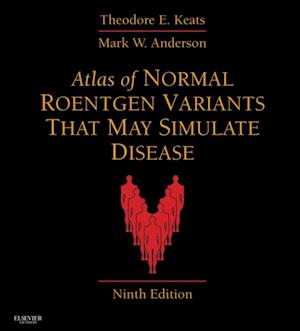 Atlas of Normal Roentgen Variants That May Simulate Disease E-Book