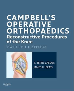 Campbell's Operative Orthopaedics: Reconstructive Procedures of the Knee E-Book