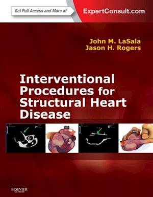 Interventional Procedures for Adult Structural Heart Disease E-Book