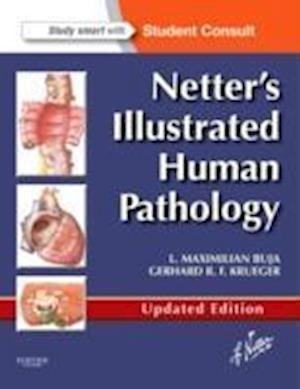 Netter's Illustrated Human Pathology Updated Edition