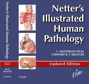 Netter's Illustrated Human Pathology Updated Edition E-book