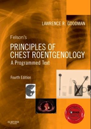 Felson's Principles of Chest Roentgenology E-Book