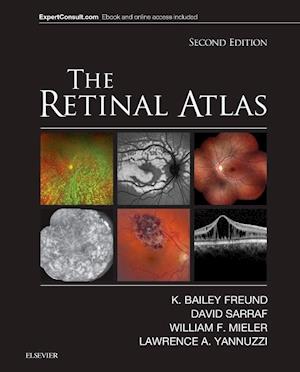 The Retinal Atlas