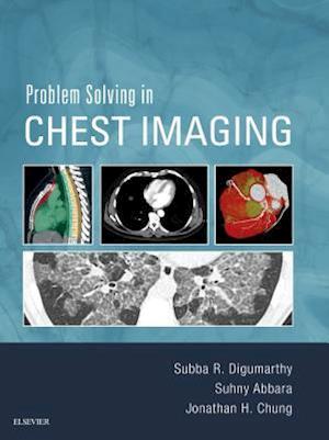 Problem Solving in Chest Imaging