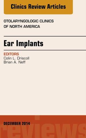 Ear Implants, An Issue of Otolaryngologic Clinics of North America