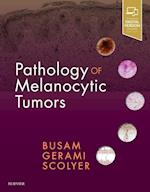 Pathology of Melanocytic Tumors