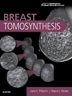 Breast Tomosynthesis E-Book