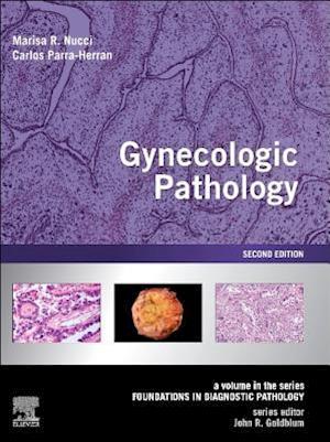 Gynecologic Pathology E-Book