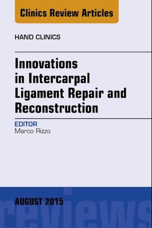 Innovations in Intercarpal Ligament Repair and Reconstruction