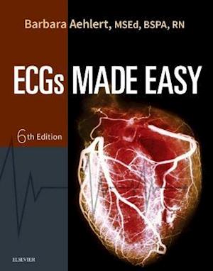 Ecgs Made Easy