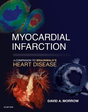 Myocardial Infarction: A Companion to Braunwald's Heart Disease E-Book