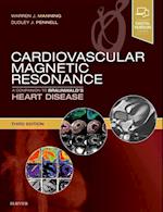 Cardiovascular Magnetic Resonance