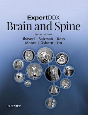 ExpertDDx: Brain and Spine E-Book