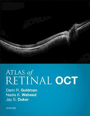 Atlas of Retinal OCT: Optical Coherence Tomography