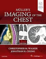 Muller's Imaging of the Chest
