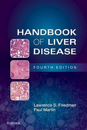 Handbook of Liver Disease E-Book