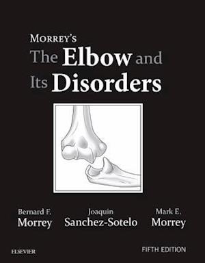 Morrey's The Elbow and Its Disorders E-Book