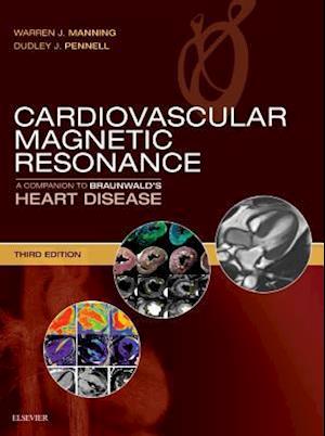 Cardiovascular Magnetic Resonance