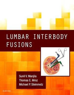 Lumbar Interbody Fusions