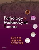 Pathology of Melanocytic Tumors E-Book