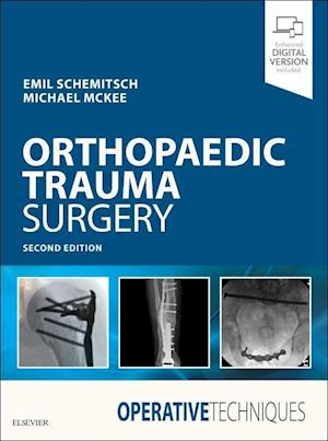 Operative Techniques: Orthopaedic Trauma Surgery