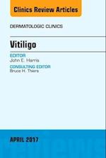 Vitiligo, An Issue of Dermatologic Clinics