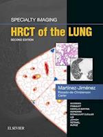 Specialty Imaging: HRCT of the Lung E-Book