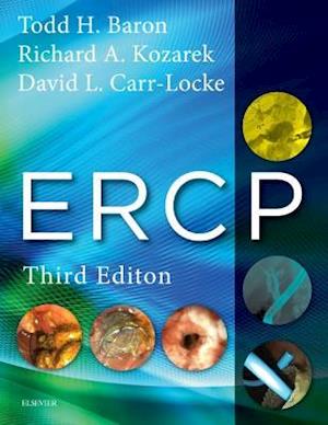 ERCP E-Book