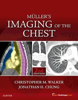 Muller's Imaging of the Chest E-Book