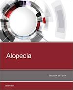 Alopecia