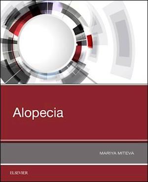 Alopecia