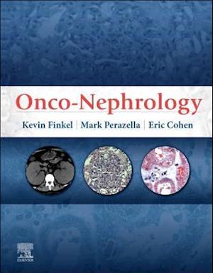 Onco-Nephrology