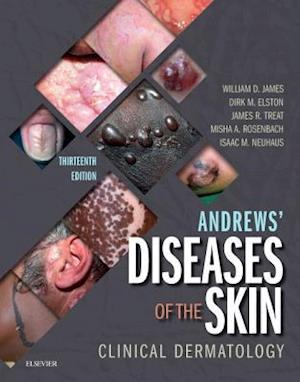 Andrews' Diseases of the Skin