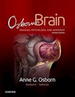 Osborn's Brain E-Book