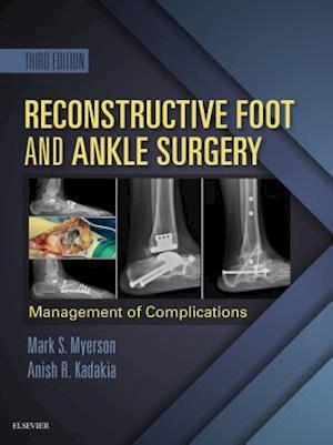 Reconstructive Foot and Ankle Surgery: Management of Complications