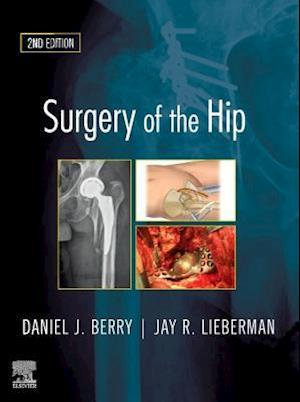 Surgery of the Hip E-Book