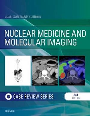 Nuclear Medicine and Molecular Imaging: Case Review Series E-Book