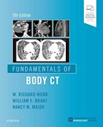 Fundamentals of Body CT