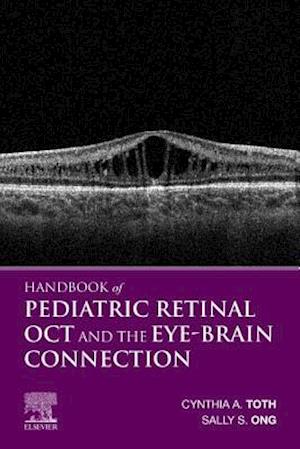 Handbook of Pediatric Retinal OCT and the Eye-Brain Connection