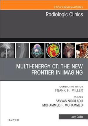 Multi-Energy CT: The New Frontier in Imaging, An Issue of Radiologic Clinics of North America