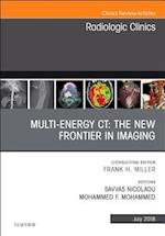 Multi-Energy CT: The New Frontier in Imaging, An Issue of Radiologic Clinics of North America