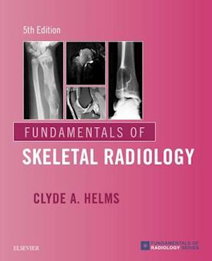 Fundamentals of Skeletal Radiology E-Book