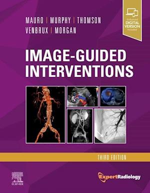 Image-Guided Interventions