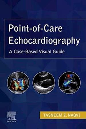 Point-of-Care Echocardiography, E-Book