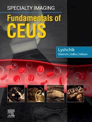 Specialty Imaging: Fundamentals of CEUS E-Book