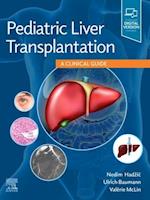 Pediatric Liver Transplantation