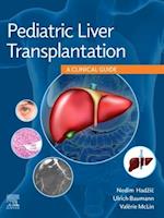 Pediatric Liver Transplantation