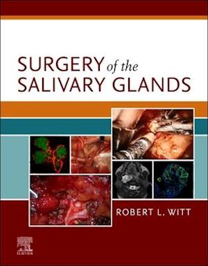 Surgery of the Salivary Glands E-Book