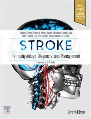 Stroke E-Book