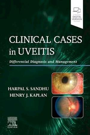 Clinical Cases in Uveitis